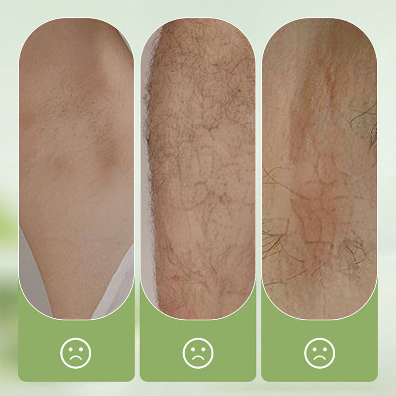 🧴 SCONTO DEL 50%! 🪒 Set delicato e delicato – Crema depilatoria + rasoio – Indolore, per pelli sensibili, senza macchie scure né peli residui 🌸