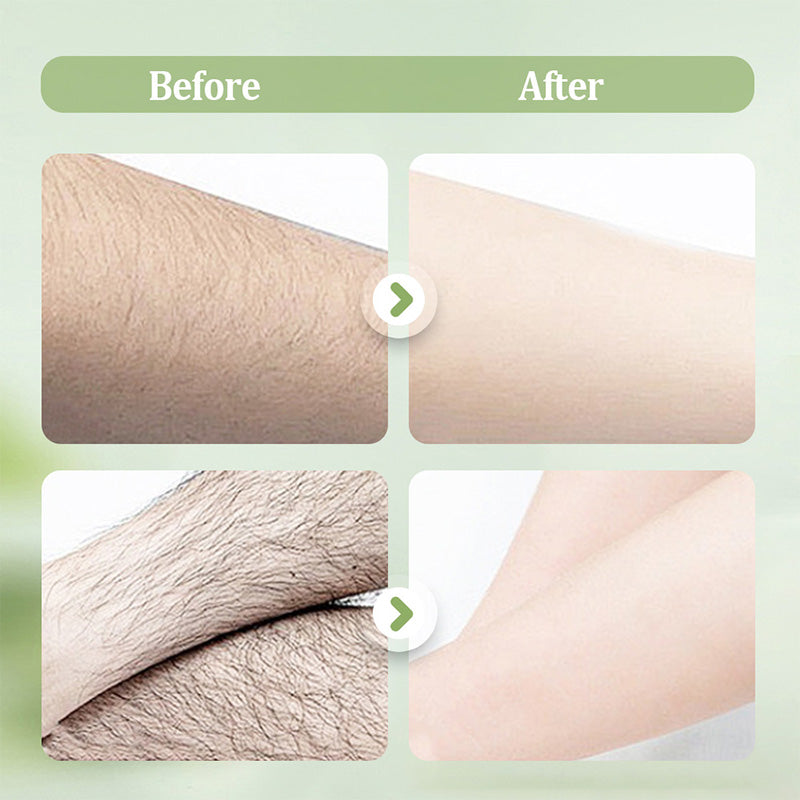 🧴 SCONTO DEL 50%! 🪒 Set delicato e delicato – Crema depilatoria + rasoio – Indolore, per pelli sensibili, senza macchie scure né peli residui 🌸