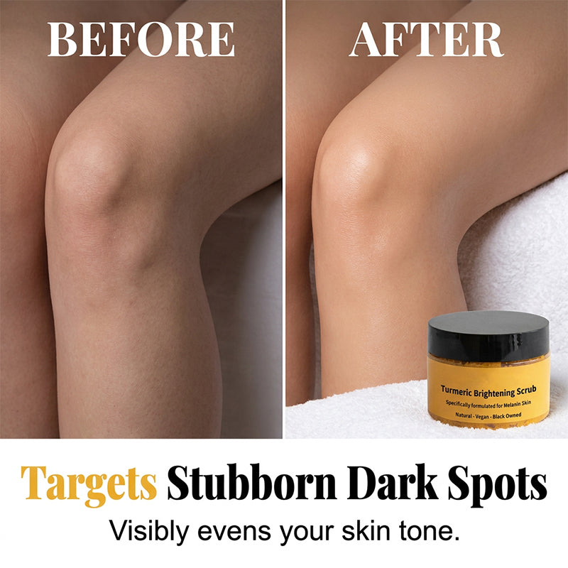 🛁SCONTO DEL 50%🧴 Scrub corpo illuminante alla curcuma | Esfoliazione con sale marino naturale · Olio di jojoba nutriente · Attenua l'aspetto spento · Per viso e corpo
